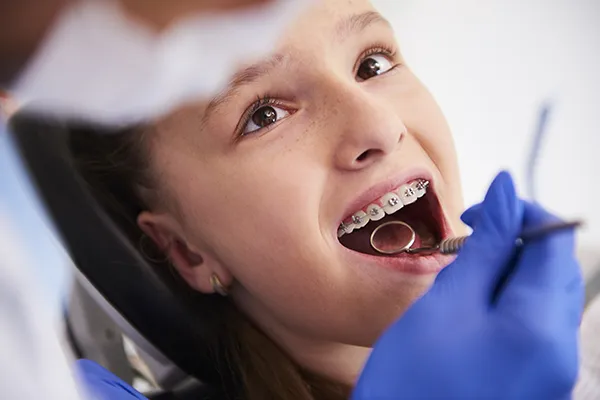 Orthodontie enfant Sillingy – accompagnement doux et adapté aux plus jeunes